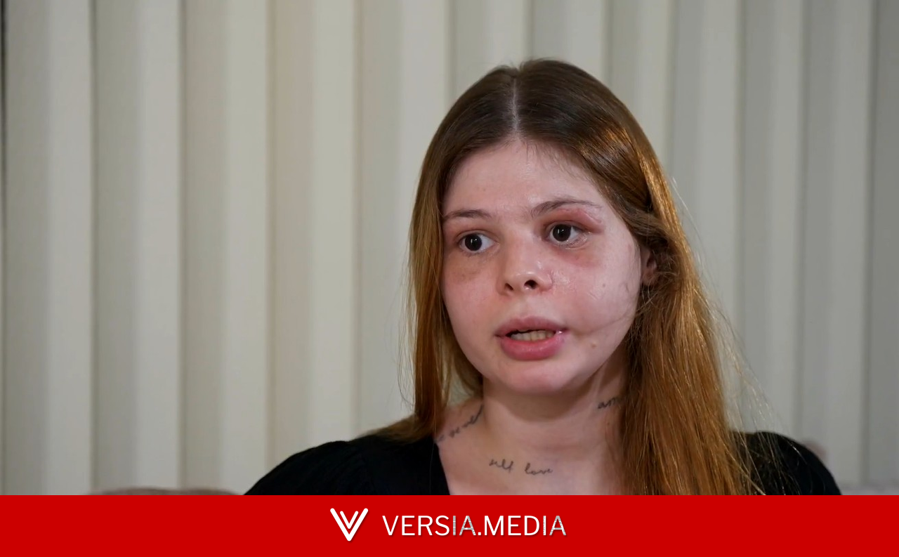 'Me sinto perdida': médica que levou socos no rosto relata dificuldade em lidar com marcas da agressão