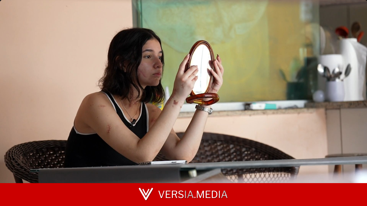 Ataques ao rosto de mulheres revelam intenção de apagar a identidade das vítimas, apontam pesquisadores