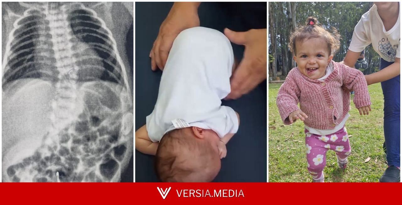 Como a fisioterapia precoce mudou a trajetória de bebê prematura com risco de não andar nem falar em SP