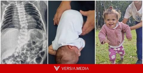 Como a fisioterapia precoce mudou a trajetória de bebê prematura com risco de não andar nem falar em SP